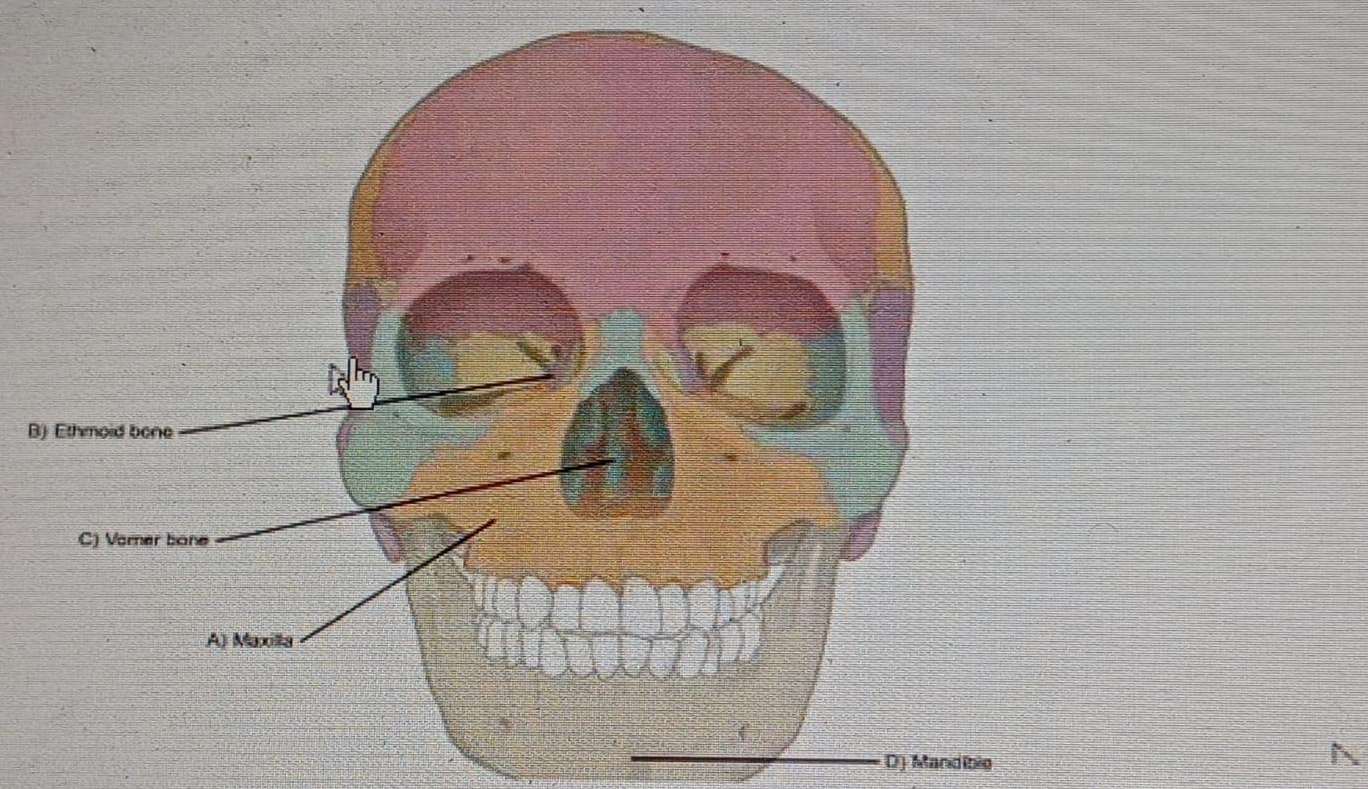 Diagram for question