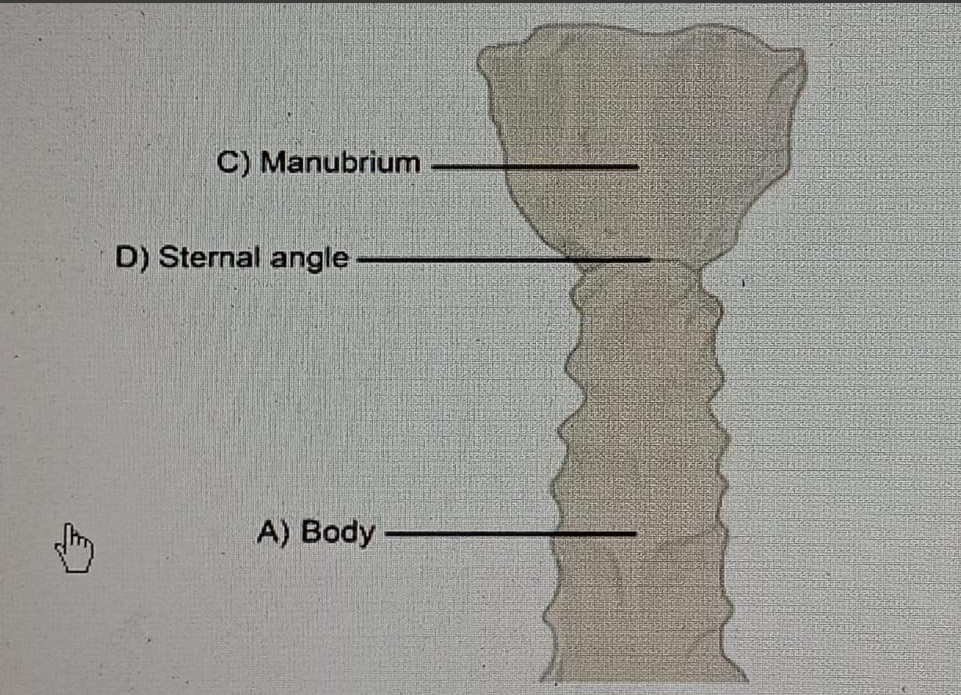 Diagram for question