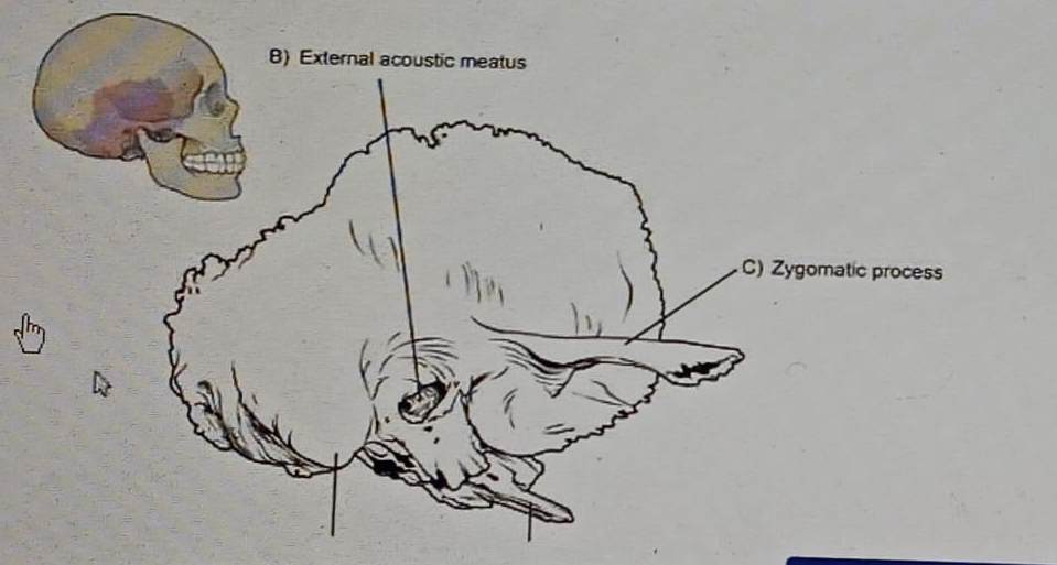 Diagram for question