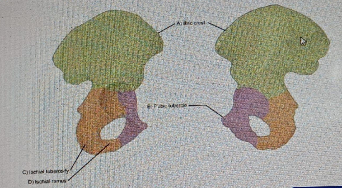 Diagram for question