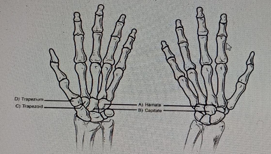 Diagram for question