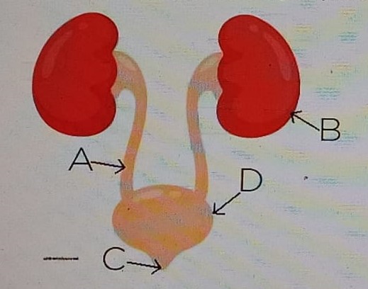 Diagram for question