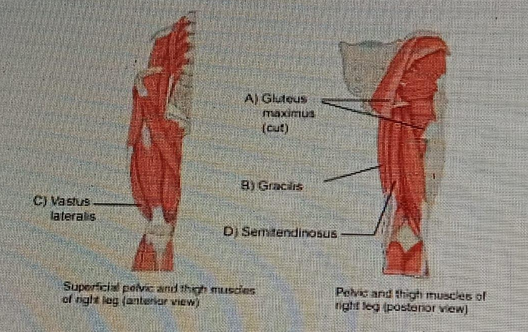 Diagram for question